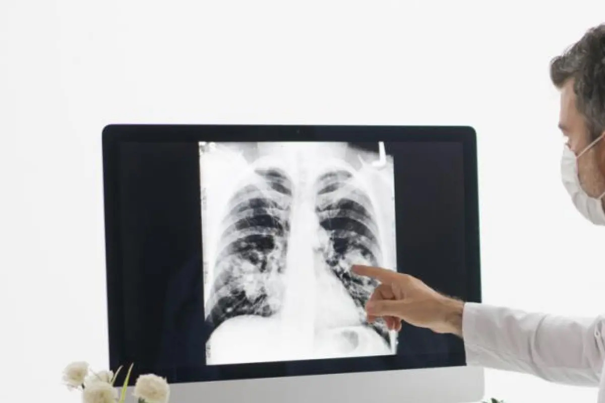 Sociedad Estadounidense contra el cáncer, cáncer de pulmón, guía actualizada Diagnostico red latina